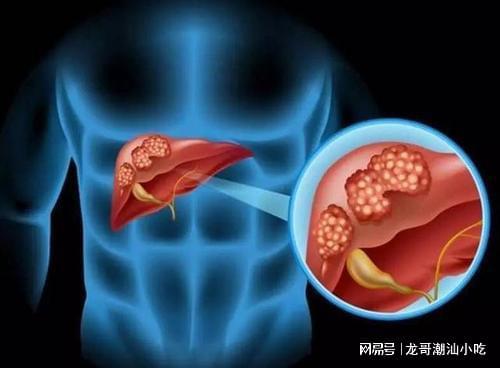 必威 betway必威营养师：秋天要注意养肝多吃以下6种食品可以帮助肝疏肝调气(图1)